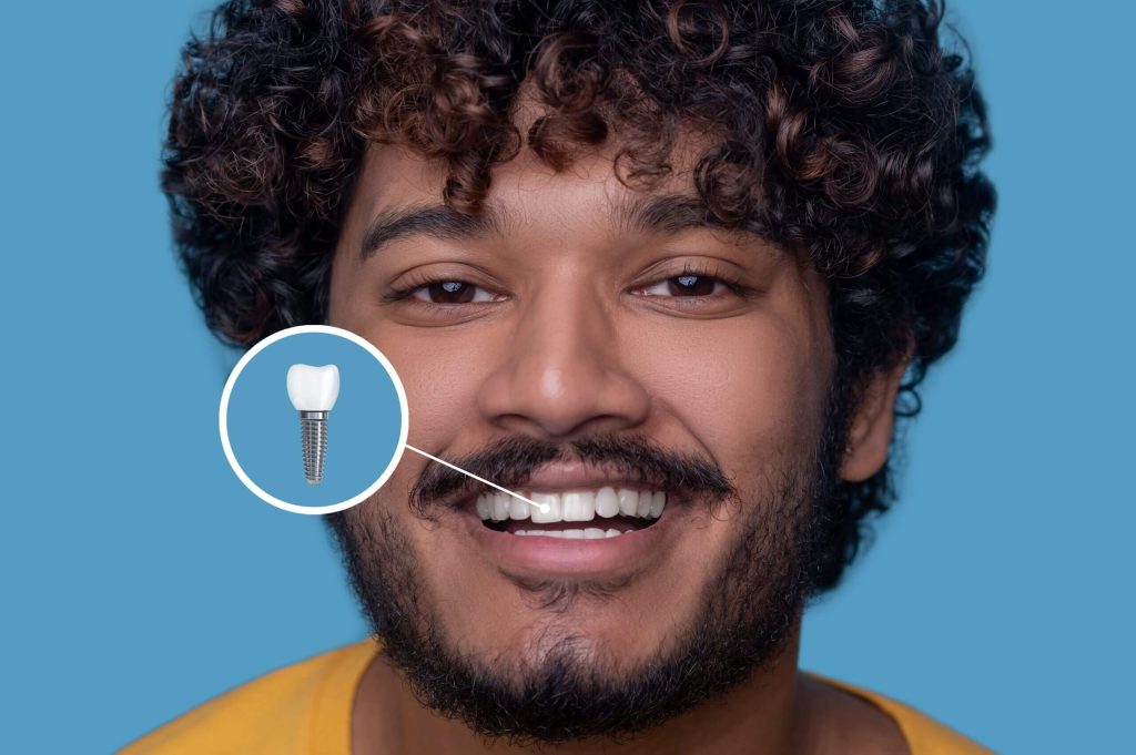 Nepean Dental Implants
